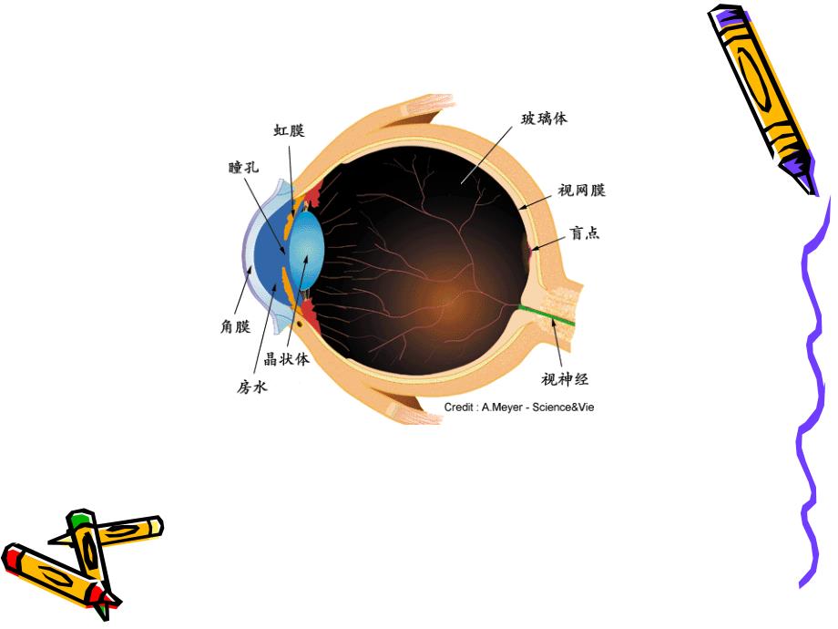 白内障临床诊断护理精编ppt_第4页