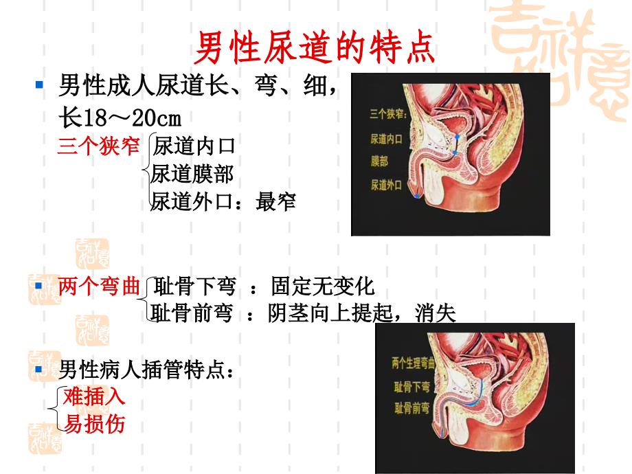 留置导尿技术操作.ppt_第4页