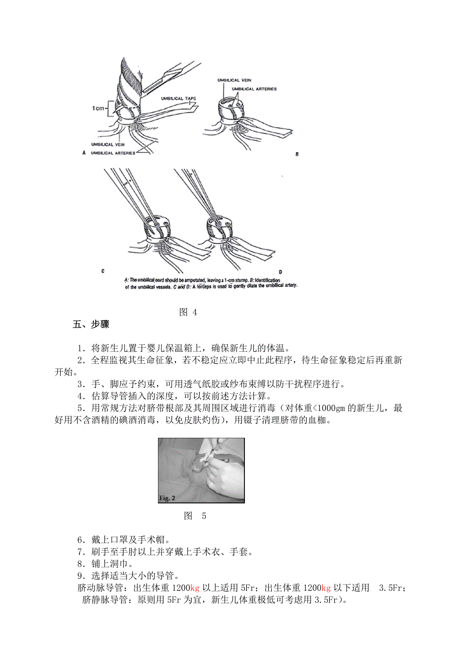 新生儿脐血管插管操作手册.doc_第4页