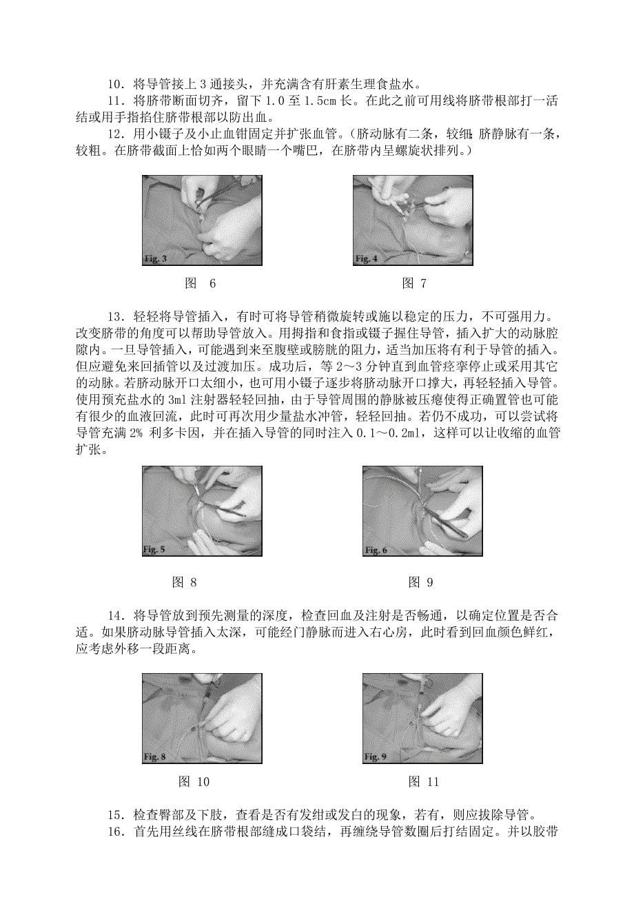 新生儿脐血管插管操作手册.doc_第5页