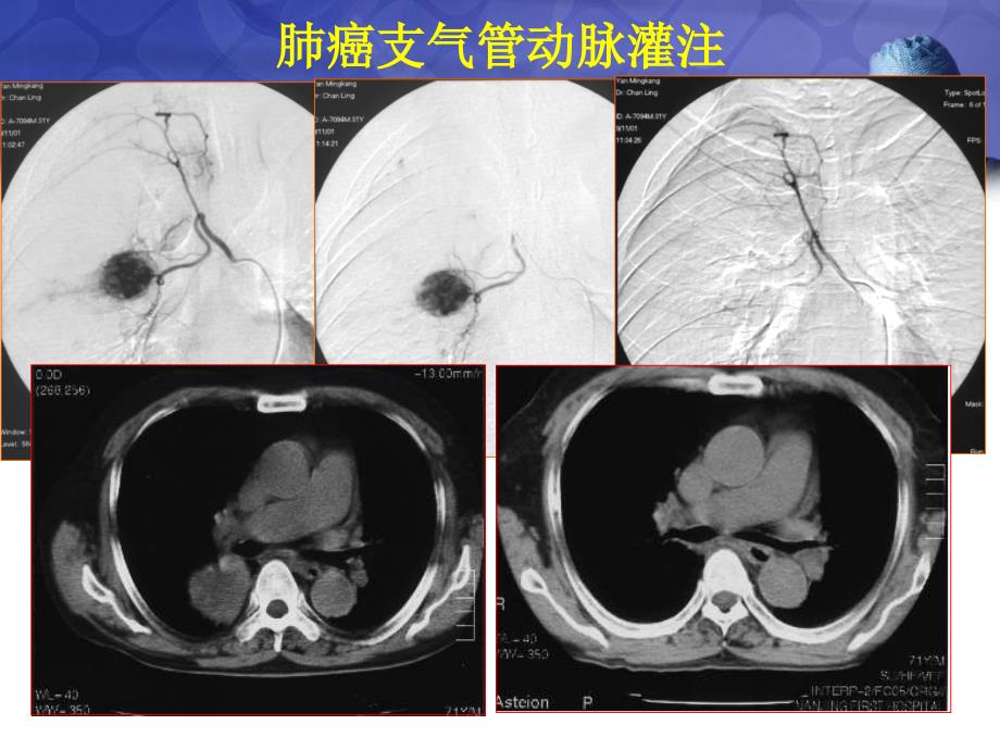 血管介入科门诊我们关注什么课件_第4页