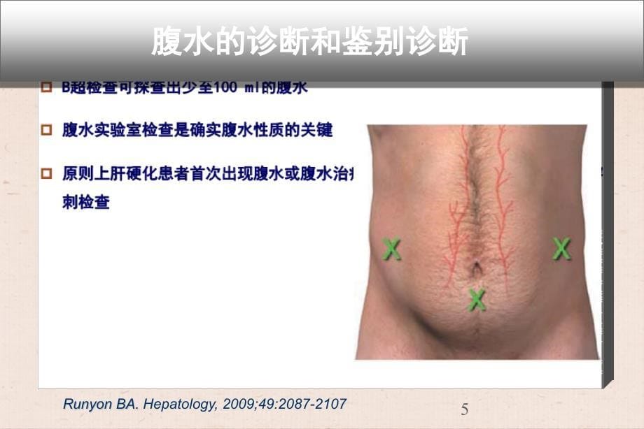 肝腹水的规范性诊治ppt课件_第5页