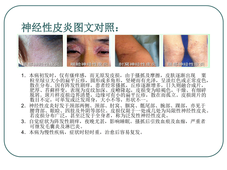 神经性皮炎的症状_第3页