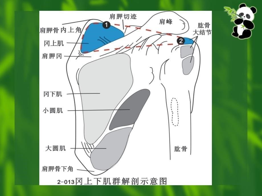 冈上肌伤课件_第5页