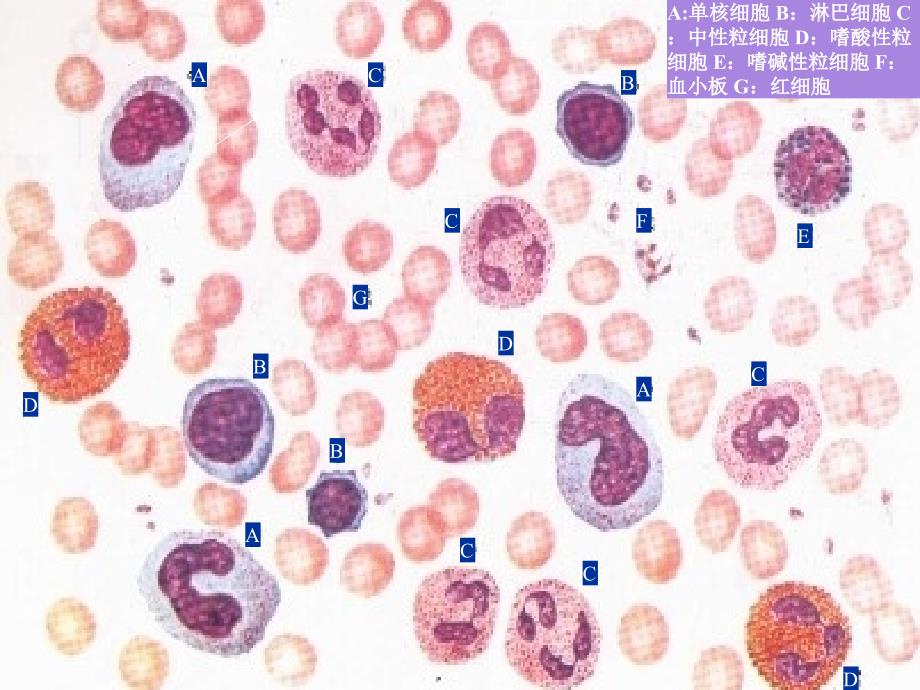 病理学实验课件：3实验三 炎症_第4页