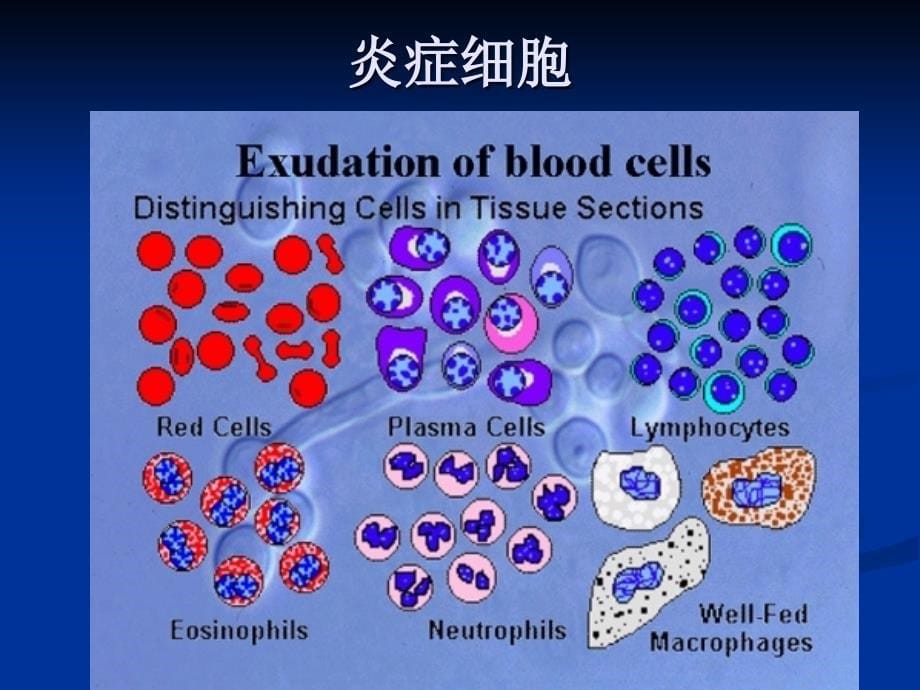 病理学实验课件：3实验三 炎症_第5页