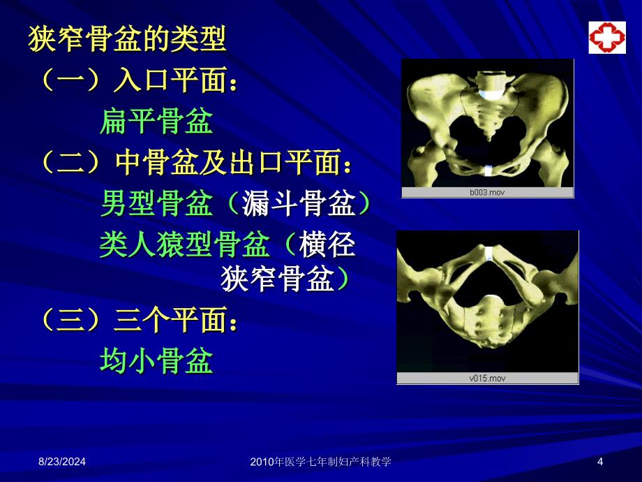 妇产科学课件：2_2异常分娩_第4页