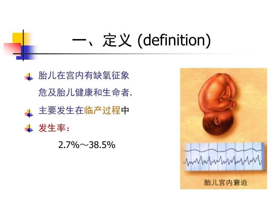 胎儿宫内窘迫-课件_第5页