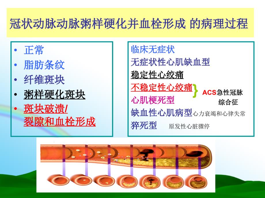 心绞痛的药物治疗_第4页