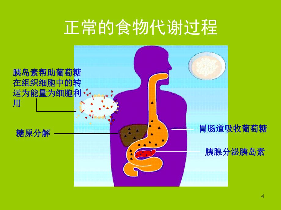 糖尿病基础知识与防治ppt课件_第4页