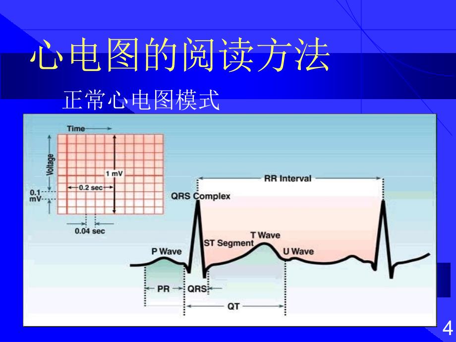 心电图的阅读方法文档资料_第4页