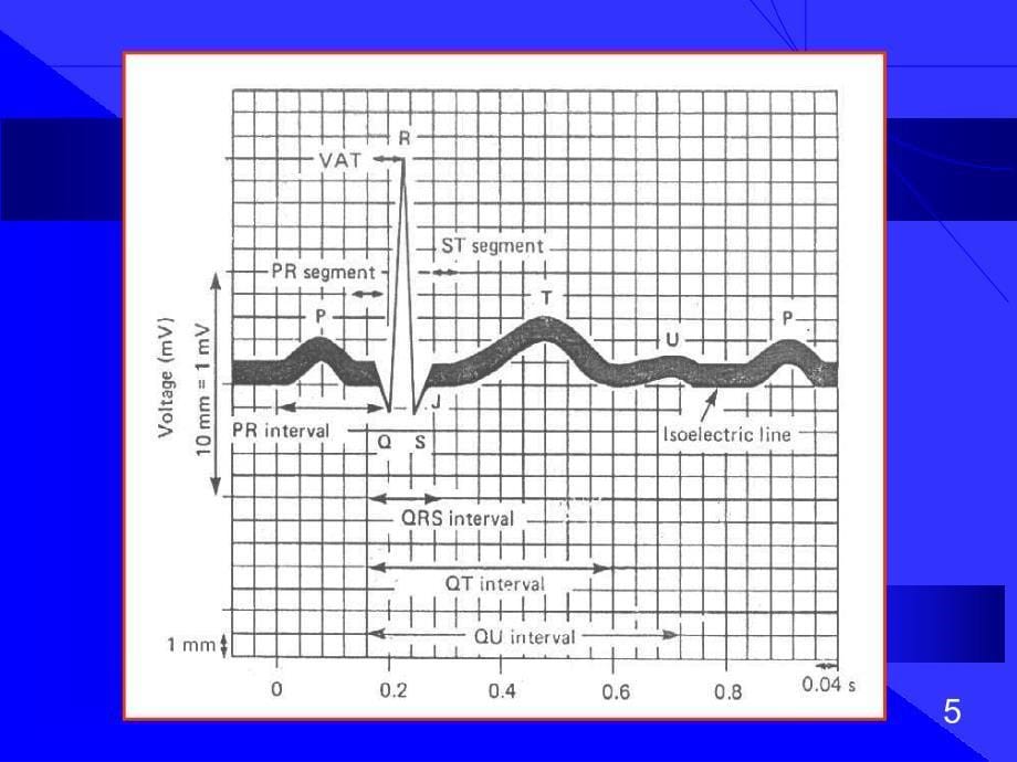 心电图的阅读方法文档资料_第5页