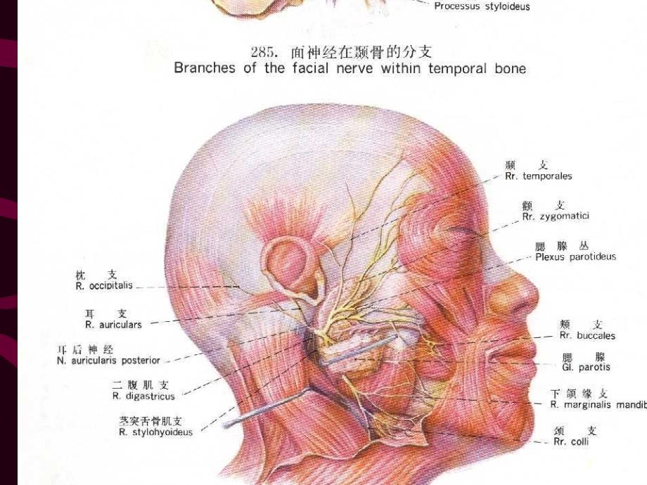 腮腺手术ppt参考课件_第3页