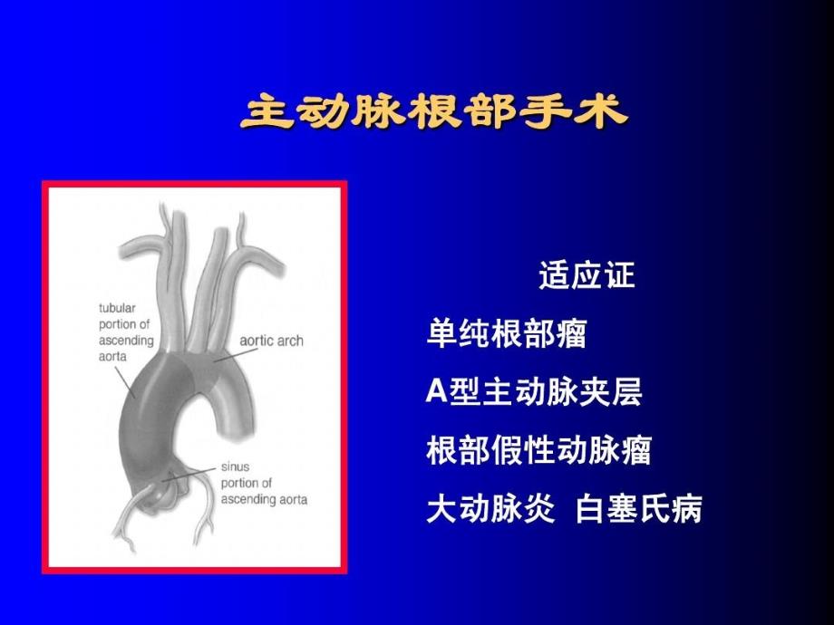 主动脉外科的常见术式55页PPT课件_第4页