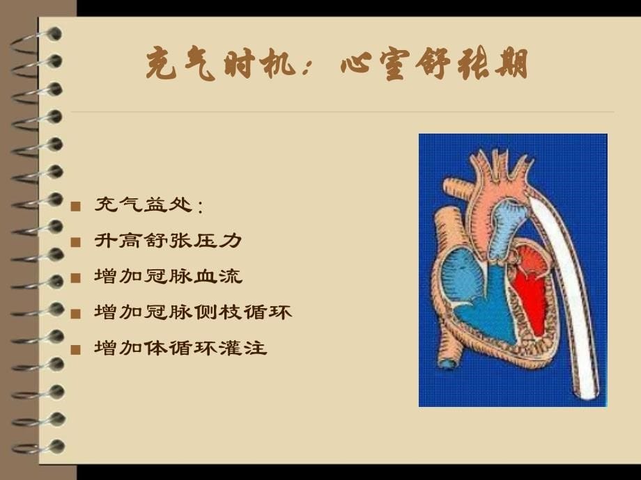 医学专题：主动脉球囊反搏术_第5页