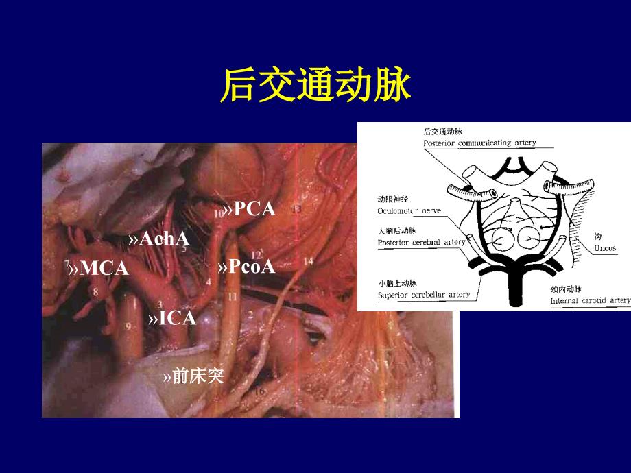 [临床医学]丘脑底节区脑血管解剖_第3页