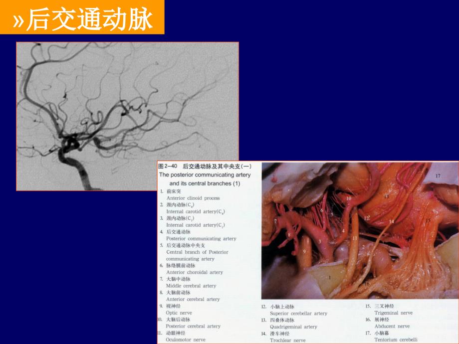 [临床医学]丘脑底节区脑血管解剖_第4页