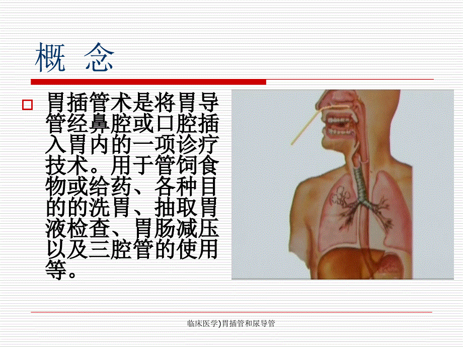 临床医学胃插管和尿导管课件_第2页