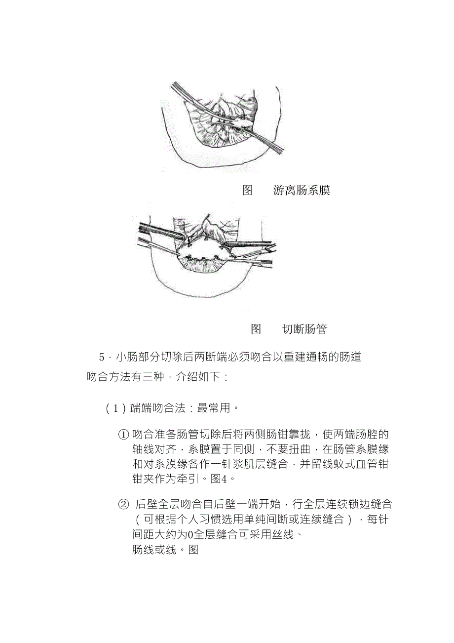 动物肠切除肠吻合术_第4页