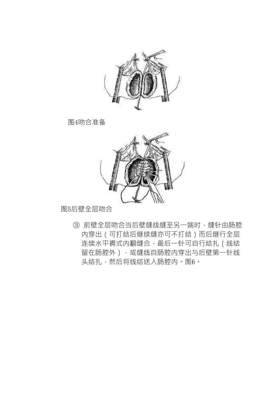 动物肠切除肠吻合术_第5页