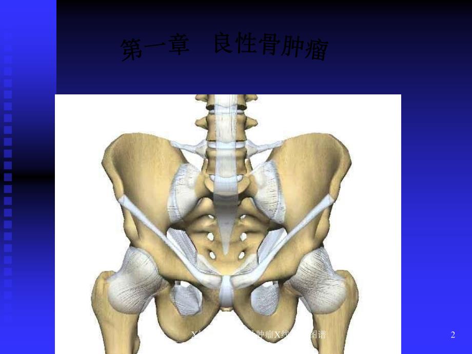 X线学习资料骨肿瘤X线病历图谱课件_第2页