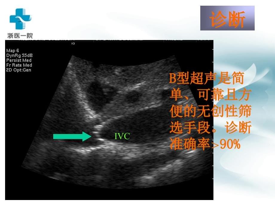 外科学教学课件：周围血管和淋巴管疾病_第5页