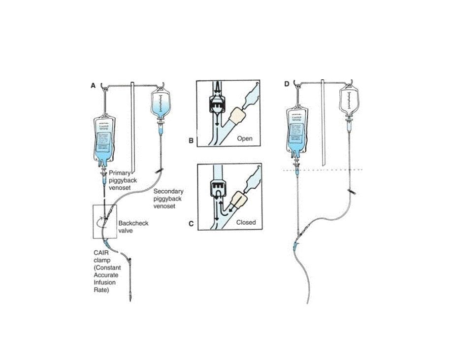 行业标准静脉输液_第5页