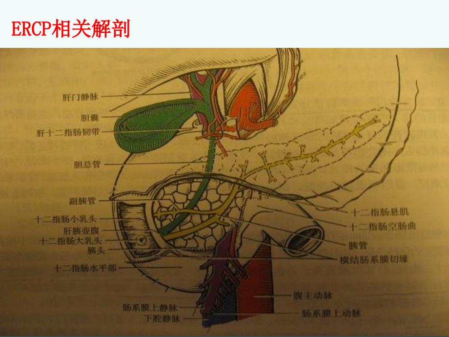 ercp与est解读_第4页