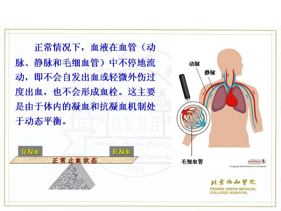 血友病病人的护理课件_第4页