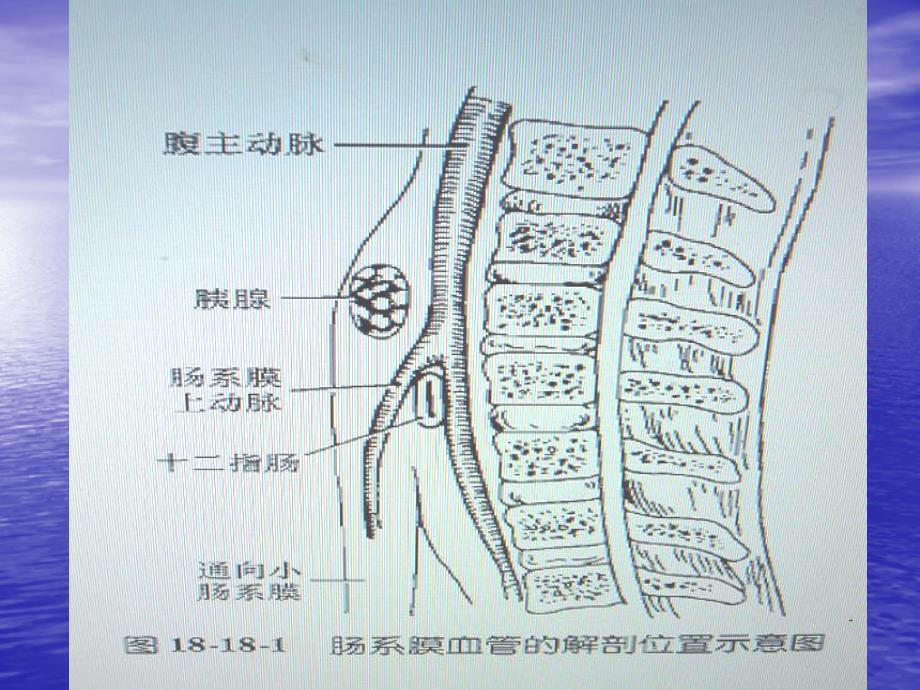 肠系膜上动脉综合征_第4页