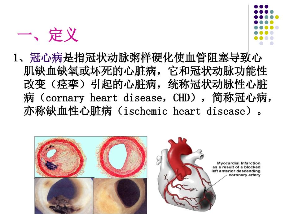 冠状动脉粥样硬化性_第2页