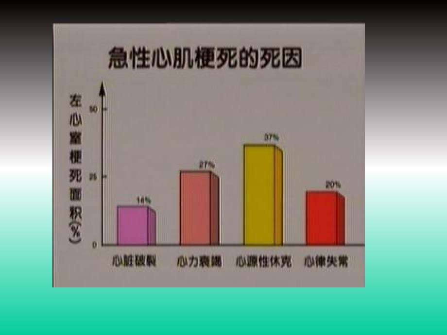 心肌梗塞PPT课件_第3页