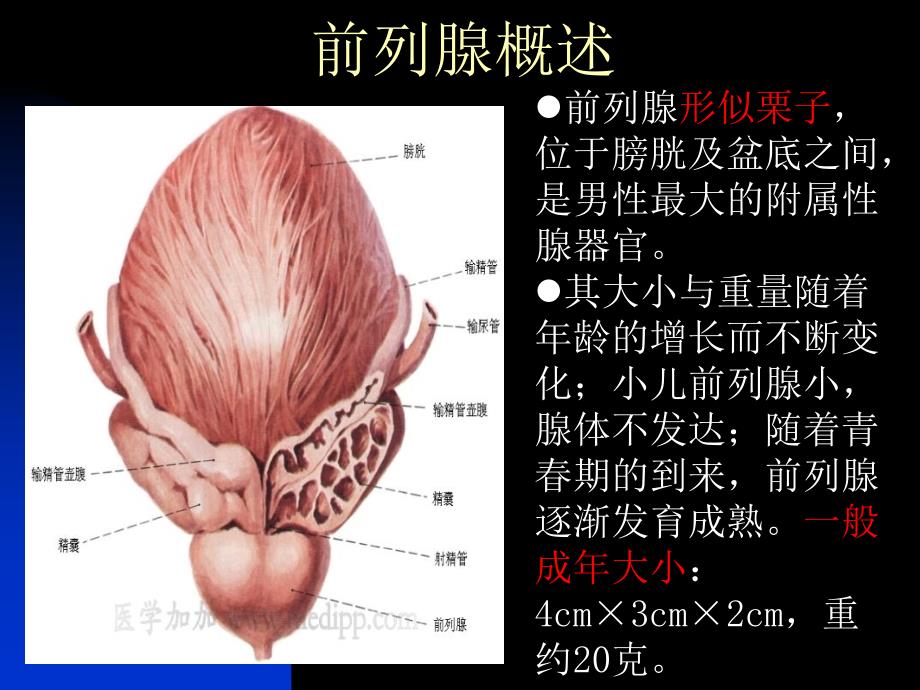 前列腺炎课件演示_第2页