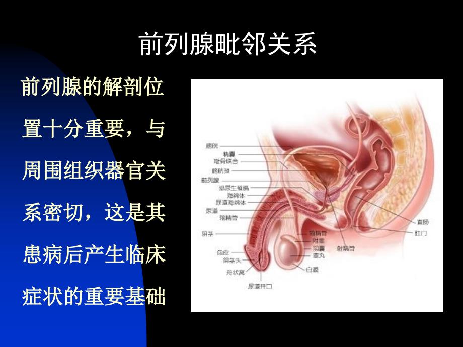 前列腺炎课件演示_第4页