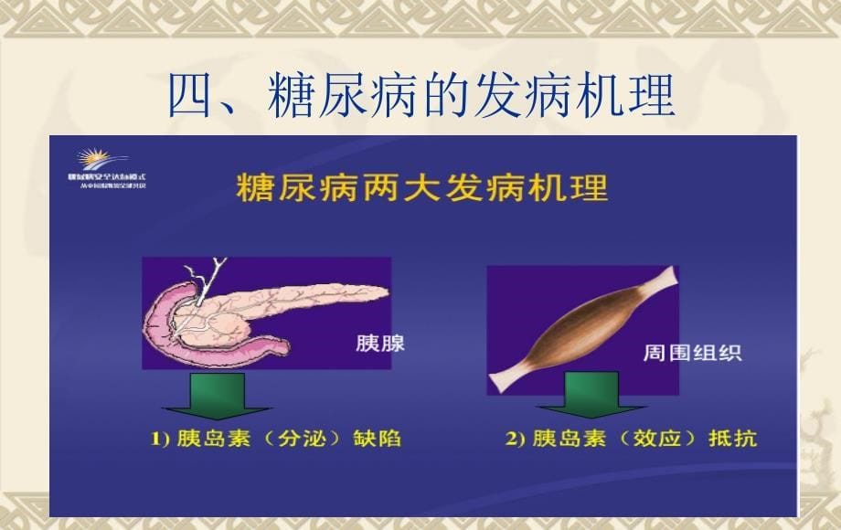 糖尿病健康教育ppt课件_第5页