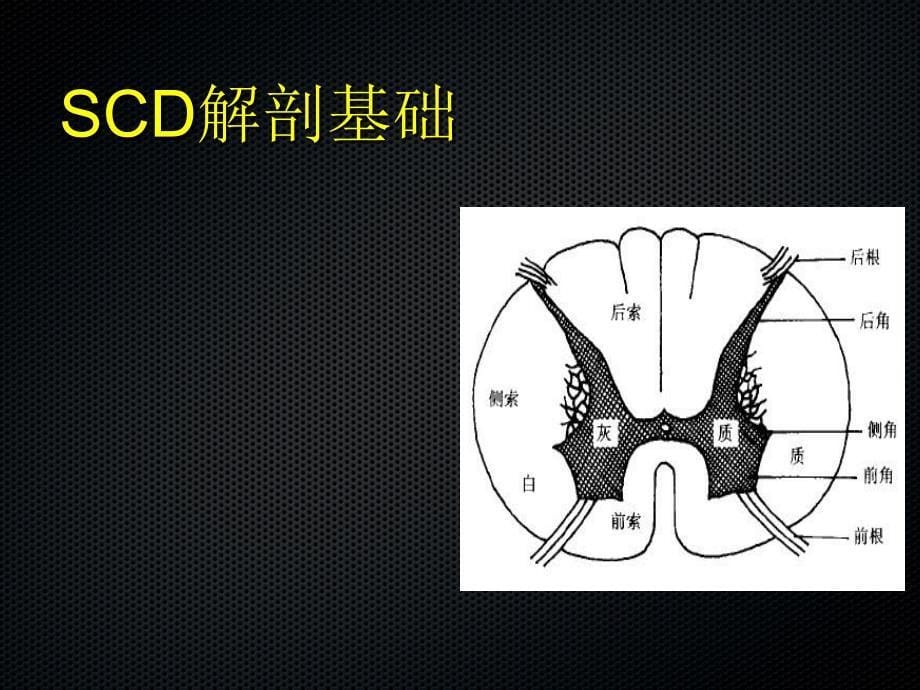 亚急性联合变性的MRI诊断ppt参考课件_第5页