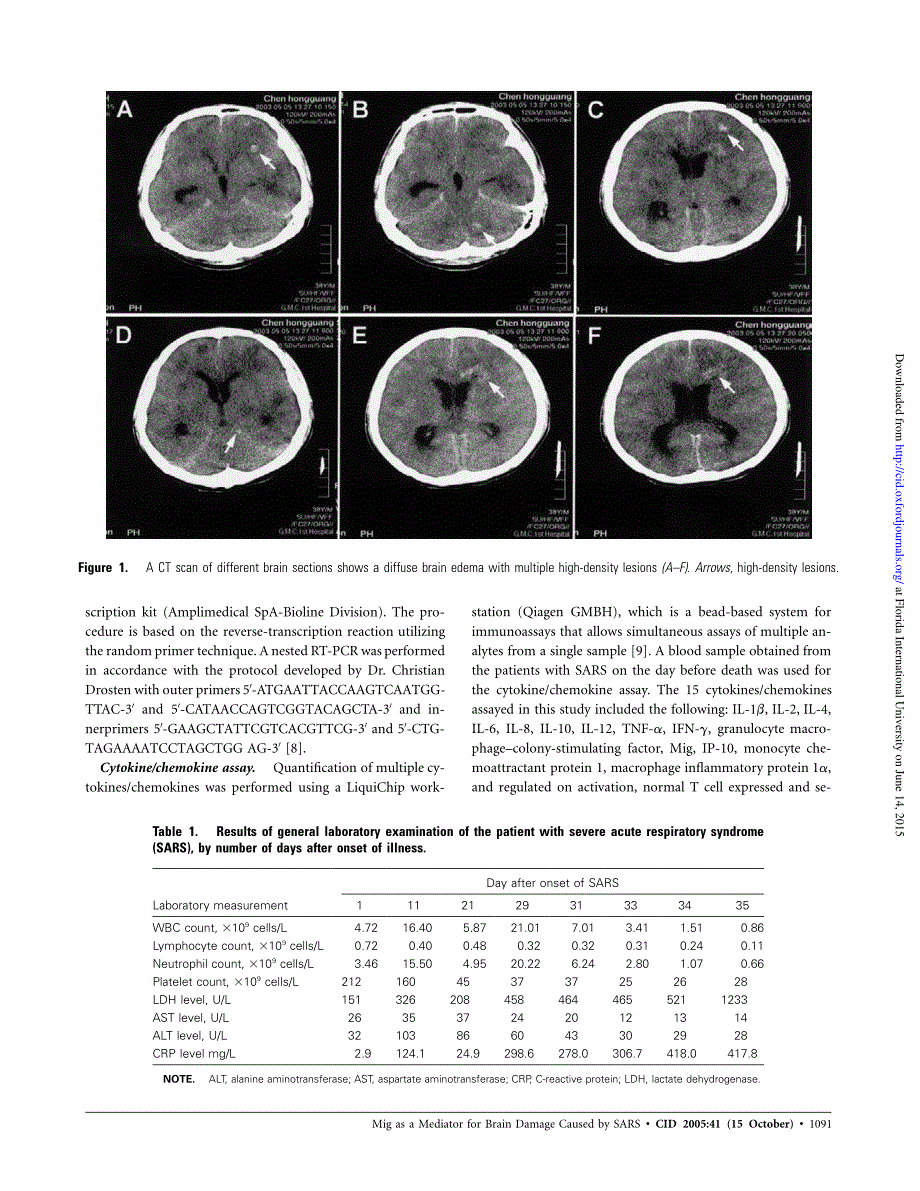 【病毒外文文献】2005 Detection of Severe Acute Respiratory Syndrome Coronavirus in the Brain_ Potential Role of the Chemokine Mig in Pat_第3页