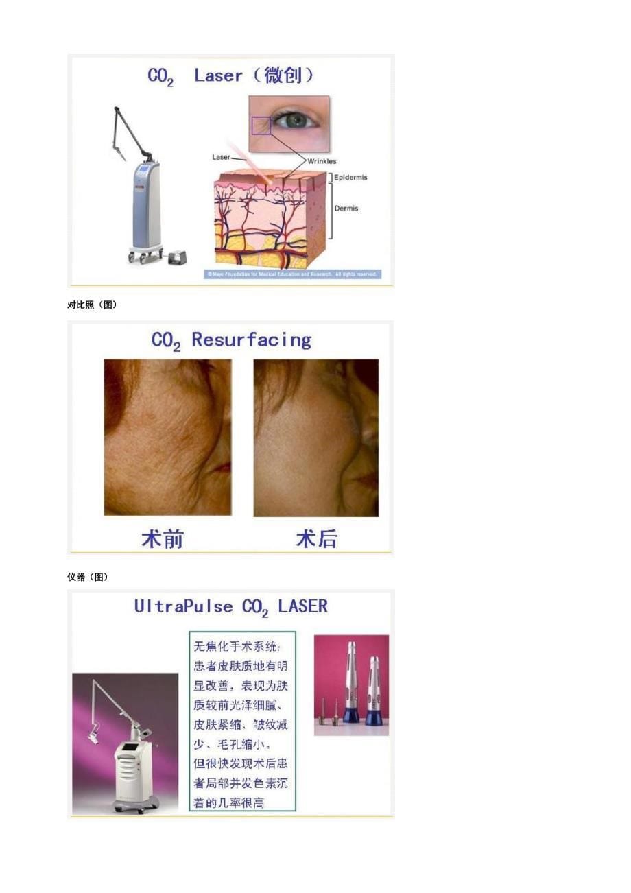 激光、射频技术在面部美容中的应用_第5页