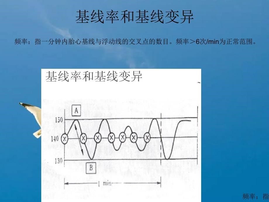 胎心率监护ppt课件_第5页