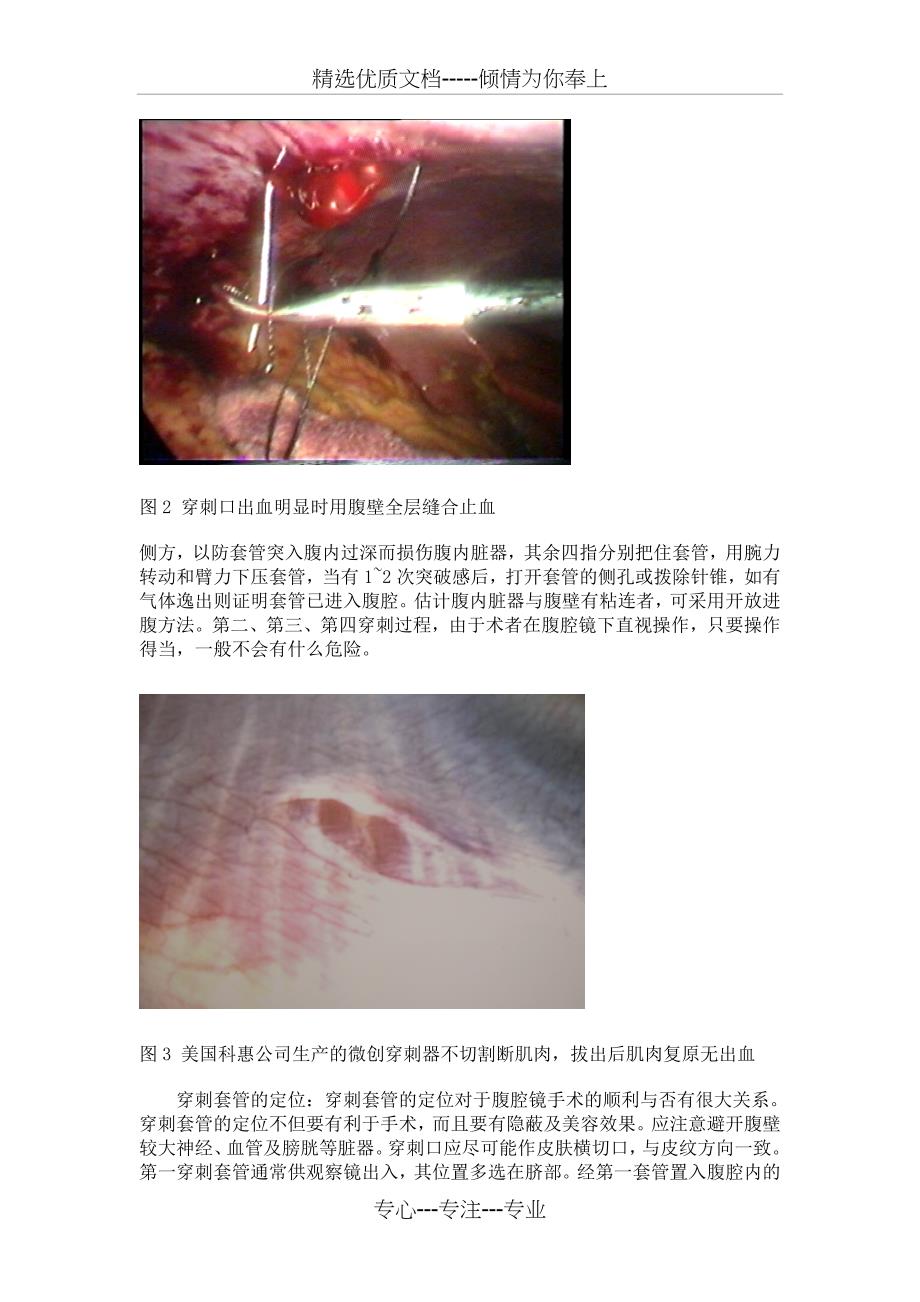 腹腔镜外科手术基本技术_第3页