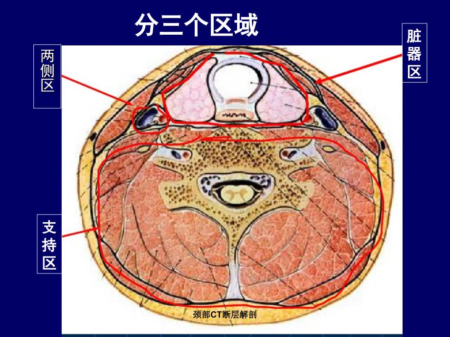 颈部CT断层解剖课件_第3页