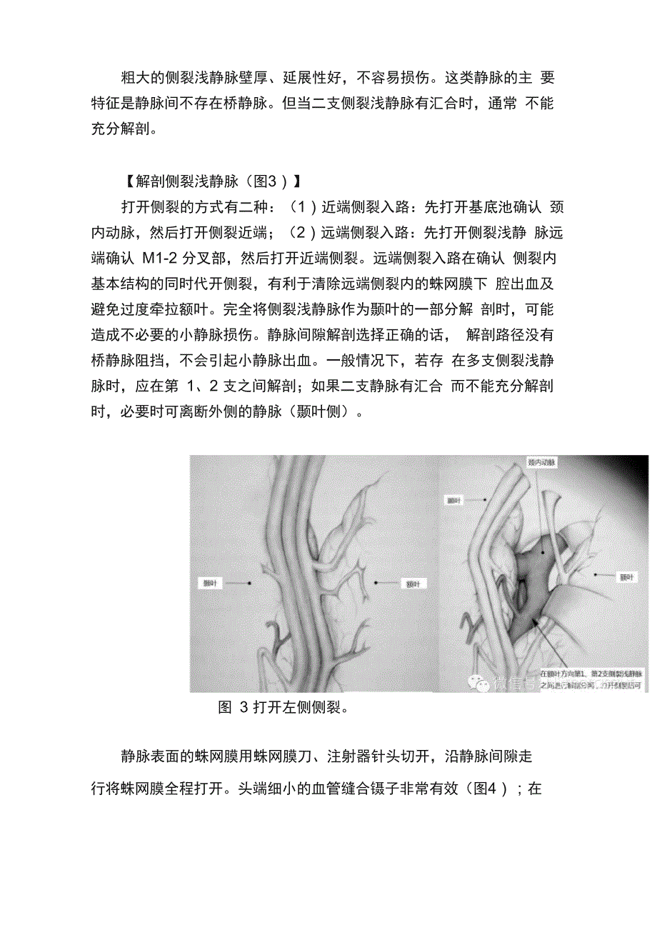 第二章：解剖侧裂_第4页