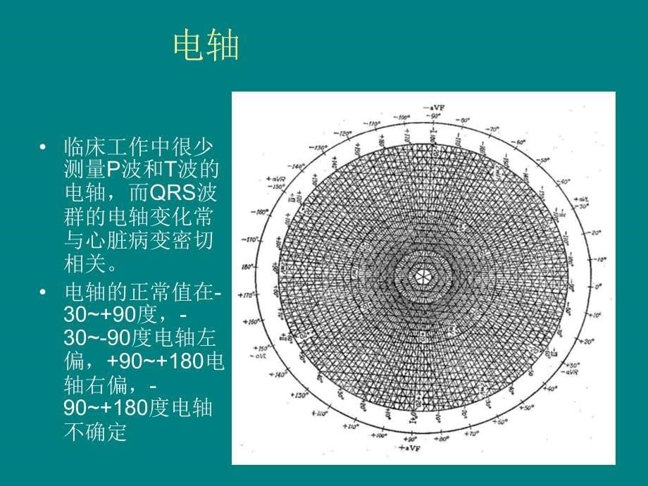 冠心病的心电图表现_第5页