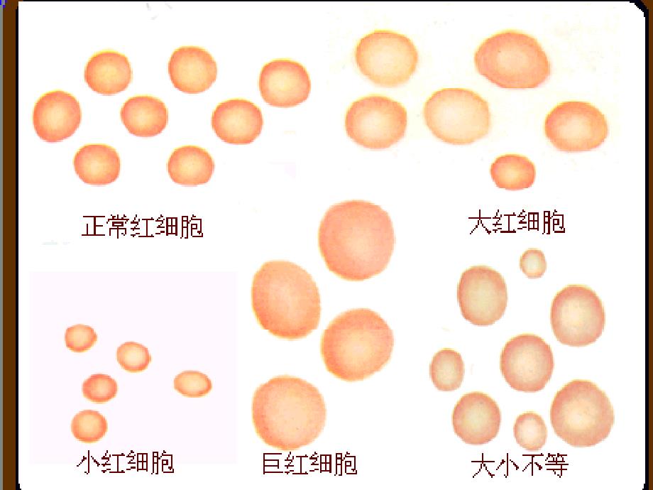 第23章血细胞分析仪的检测技术及临床应用文档资料_第2页