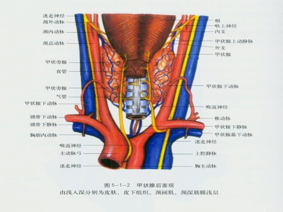 甲状腺癌的超声诊断ppt课件_第5页