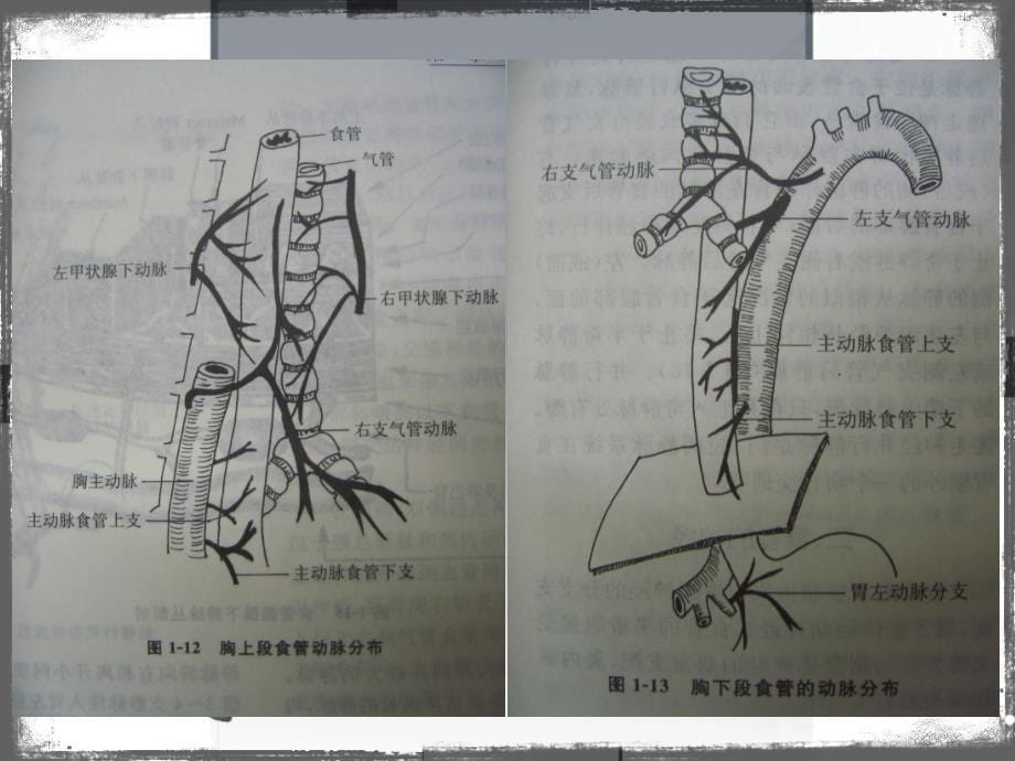 浅谈食管癌及其手术配合_第5页