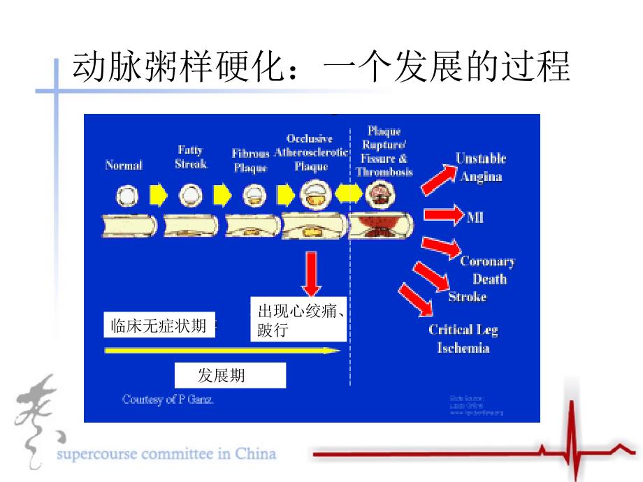 急性冠脉病症的病理机制_第3页