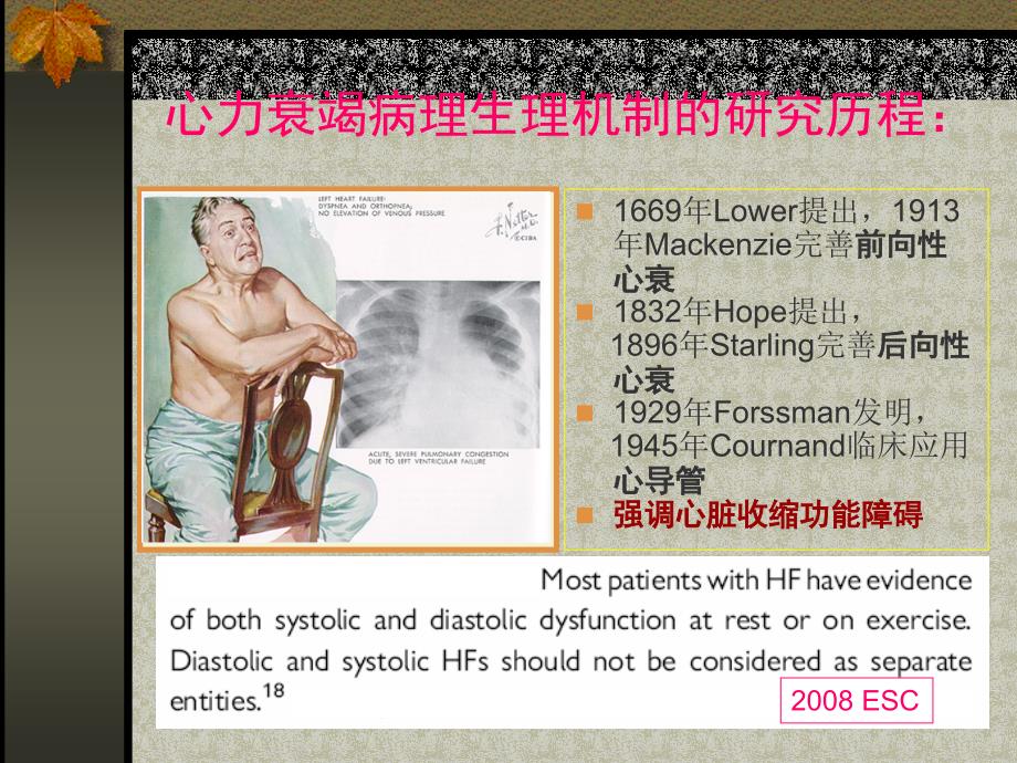 左室射血分数正常的心力衰竭_第2页