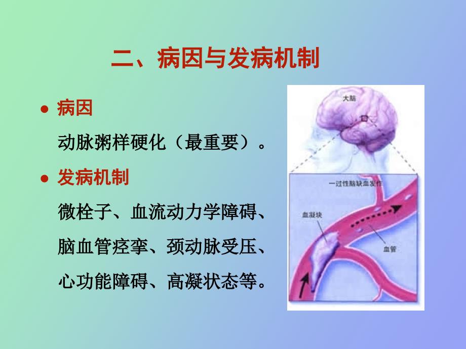 短暂性脑缺血发作_第3页