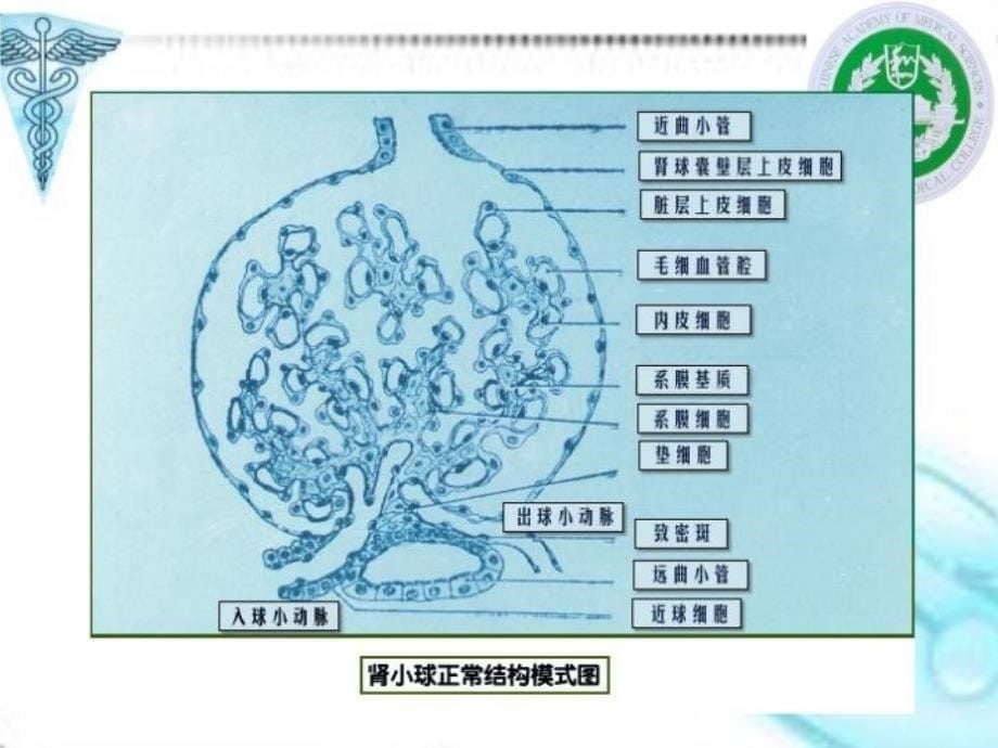 最新原发性肾小球肾炎ppt课件_第5页